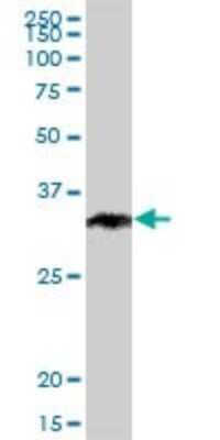 Western Blot: CHIP/STUB1 Antibody [H00010273-B01P]