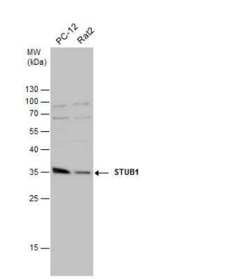 Western Blot: CHIP/STUB1 Antibody [NBP2-15882]