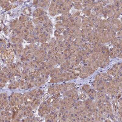 Immunohistochemistry-Paraffin: CHMP2A Antibody [NBP1-91781]