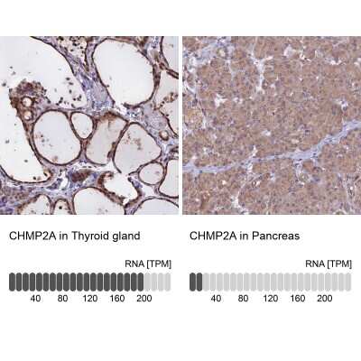Immunohistochemistry-Paraffin: CHMP2A Antibody [NBP1-91781]