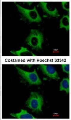 Immunocytochemistry/ Immunofluorescence: CHMP2B Antibody [NBP2-15887]