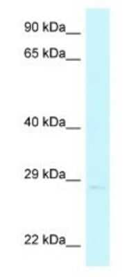 Western Blot: CHMP4A Antibody [NBP1-79920]
