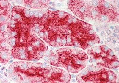 Immunohistochemistry-Paraffin: CHMP4B Antibody [NBP2-87183]