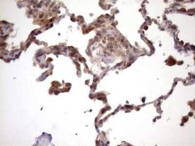 Immunohistochemistry: CHMP5 Antibody (OTI5C7) [NBP2-46283]