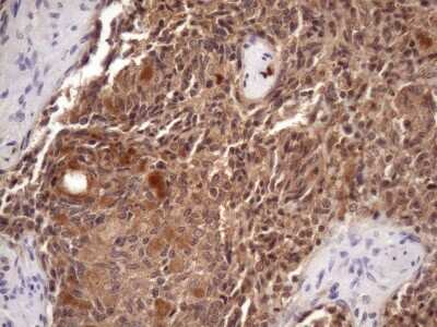 Immunohistochemistry: CHMP5 Antibody (OTI5C7) [NBP2-46283]