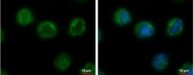 Immunocytochemistry/ Immunofluorescence: CHMP5 Antibody [NBP1-32597]