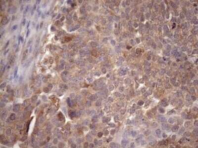 Immunohistochemistry: CHMP5 Antibody (OTI5C7) - Azide and BSA Free [NBP2-71937]