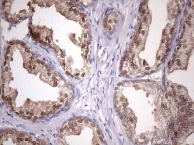 Immunohistochemistry: CHMP5 Antibody (OTI5C7) - Azide and BSA Free [NBP2-71937]