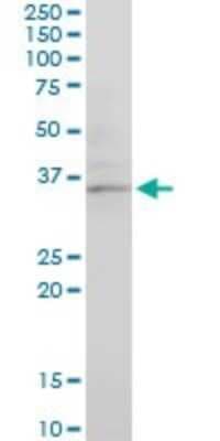 Western Blot: CHN 1 Antibody (3A3) [H00001123-M03]