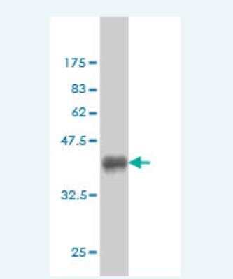 Western Blot: CHN 1 Antibody (3F8) [H00001123-M01]