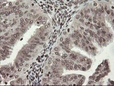 Immunohistochemistry: CHN 1 Antibody (OTI2G6) - Azide and BSA Free [NBP2-70411]
