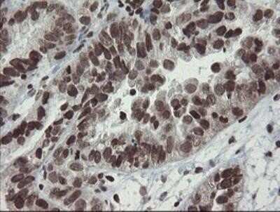Immunohistochemistry: CHN 1 Antibody (OTI2G6) - Azide and BSA Free [NBP2-70411]