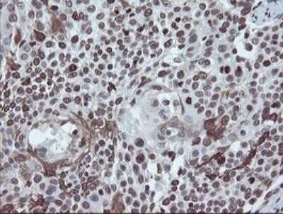 Immunohistochemistry: CHN 1 Antibody (OTI2G6) - Azide and BSA Free [NBP2-70411]