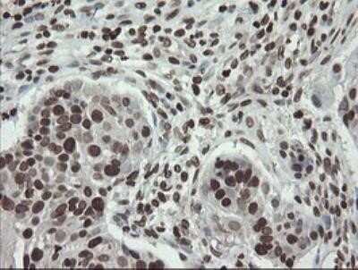 Immunohistochemistry: CHN 1 Antibody (OTI2G6) - Azide and BSA Free [NBP2-70411]