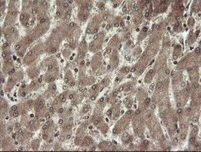 Immunohistochemistry: CHN 1 Antibody (OTI2G6) - Azide and BSA Free [NBP2-70411]
