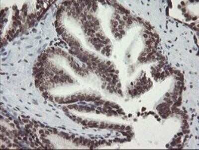 Immunohistochemistry: CHN 1 Antibody (OTI2G6) - Azide and BSA Free [NBP2-70411]