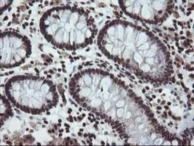 Immunohistochemistry-Paraffin: CHN 1 Antibody (OTI2G6) [NBP2-46290]