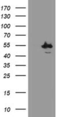 Western Blot: CHN 1 Antibody (OTI2G6) [NBP2-46290]