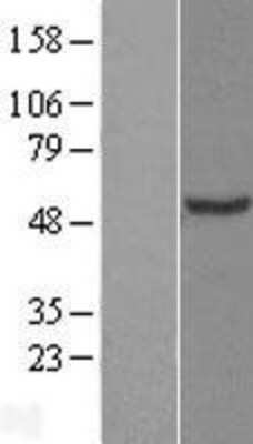 Western Blot: CHN 1 Overexpression Lysate [NBL1-09165]