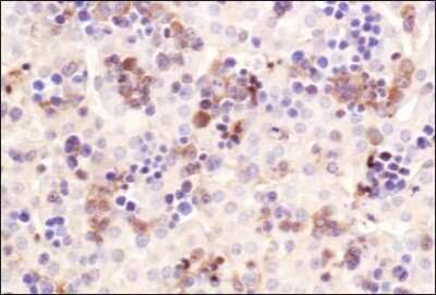 Immunohistochemistry: CHREBP Antibody - BSA Free [NB400-135]