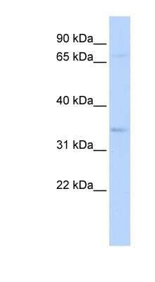 Western Blot: CHRFAM7A Antibody [NBP1-80090]