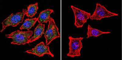 Immunocytochemistry/ Immunofluorescence: CHRND Antibody (88B) [NB120-2804]