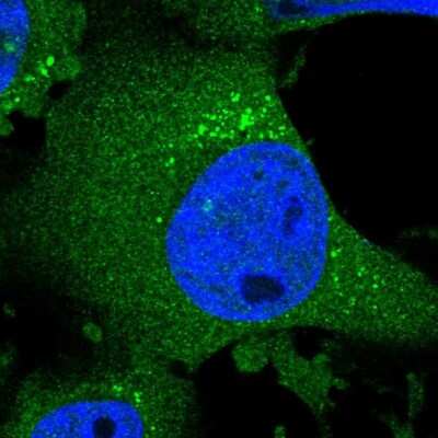 Immunocytochemistry/ Immunofluorescence: CHSS2 Antibody [NBP1-88087]
