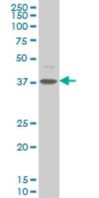 Western Blot: CHST11 Antibody (4F1) [H00050515-M01]