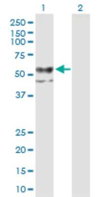 Western Blot: CHST12 Antibody [H00055501-B01P]