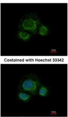 Immunocytochemistry/ Immunofluorescence: Carbohydrate Sulfotransferase 7/CHST7 Antibody [NBP2-15897]