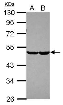 Western Blot: Carbohydrate Sulfotransferase 7/CHST7 Antibody [NBP2-15897]