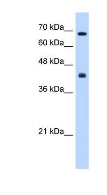 Western Blot: CHST8 Antibody [NBP1-62239]