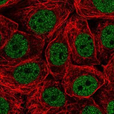 Immunocytochemistry/ Immunofluorescence: CHTF18 Antibody [NBP2-55371]
