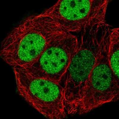Immunocytochemistry/ Immunofluorescence: CHTF18 Antibody [NBP2-58935]