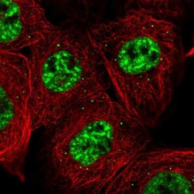 Immunocytochemistry/ Immunofluorescence: CHTOP Antibody [NBP1-88085]