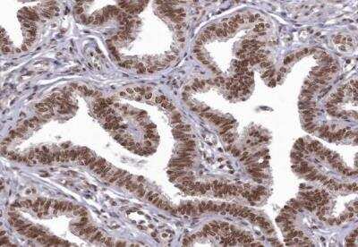 Immunohistochemistry-Paraffin: CHTOP Antibody [NBP1-88085]