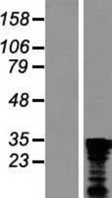 Western Blot: CHTOP Overexpression Lysate [NBL1-08330]