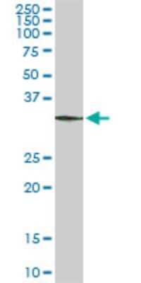 Western Blot: CIAPIN1 Antibody (5G8) [H00057019-M01]