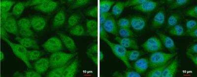 Immunocytochemistry/ Immunofluorescence: CIAPIN1 Antibody [NBP2-15901]