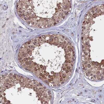 Immunohistochemistry-Paraffin: CIAPIN1 Antibody [NBP1-89096]