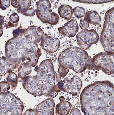 Immunohistochemistry-Paraffin: CIAPIN1 Antibody [NBP1-89096]
