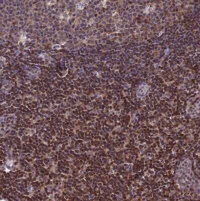 Immunohistochemistry-Paraffin: CIAPIN1 Antibody [NBP1-89096]