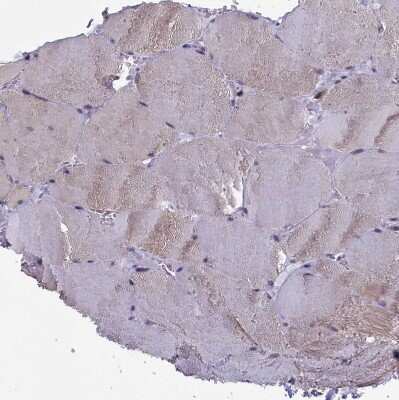 Immunohistochemistry-Paraffin: CIAPIN1 Antibody [NBP1-89096]