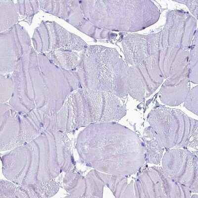 Immunohistochemistry-Paraffin: CIAPIN1 Antibody [NBP1-89097]