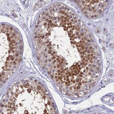 Immunohistochemistry-Paraffin: CIAPIN1 Antibody [NBP1-89097]