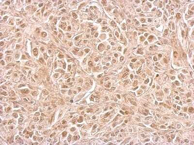 Immunohistochemistry-Paraffin: CIAPIN1 Antibody [NBP2-15901]