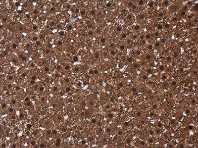 Immunohistochemistry-Paraffin: CIAPIN1 Antibody [NBP2-15901]