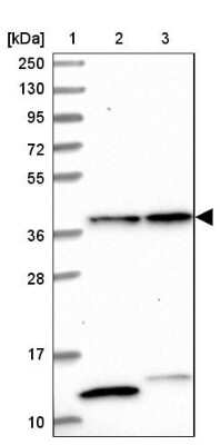 Western Blot: CIAPIN1 Antibody [NBP1-89096]
