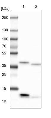 Western Blot: CIAPIN1 Antibody [NBP1-89096]