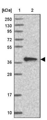 Western Blot: CIAPIN1 Antibody [NBP1-89097]